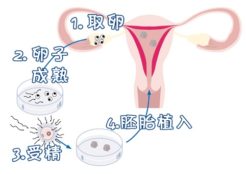 Dr. Zhang